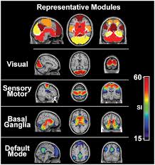 A mágneses rezonancia készülék segít az agy működésben